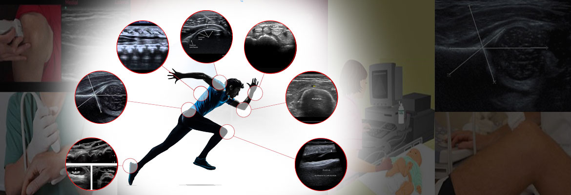Musculoskeletal-Radiology-Services